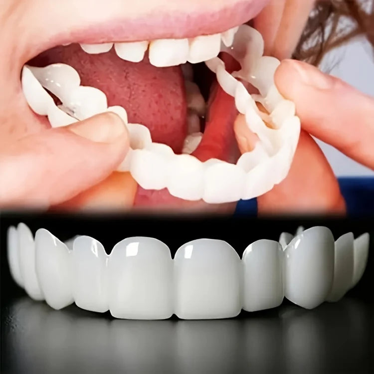Carillas Snap Smile® – Tu Nueva Sonrisa en Segundos, Sin Dolor y Sin Gastar de Más