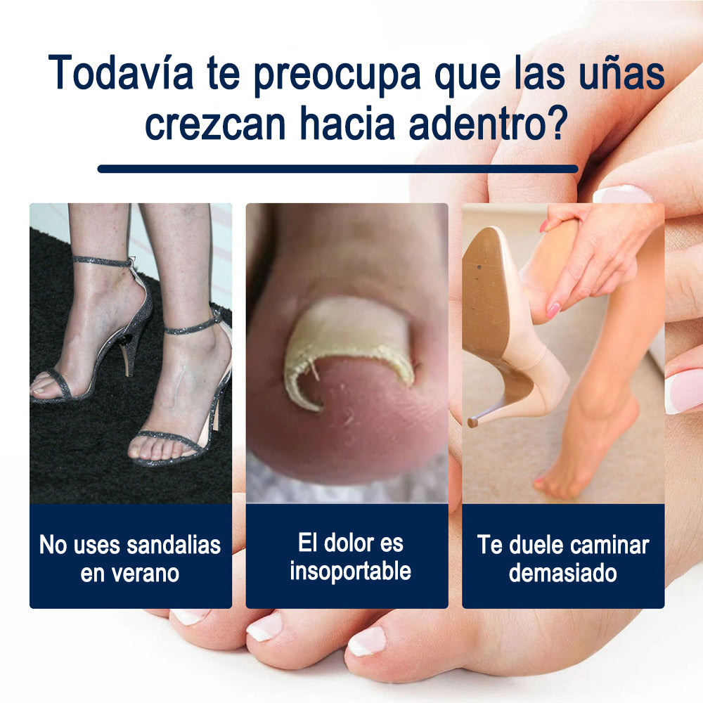 Parches Dr.Scholl's® para uñas encarnadas